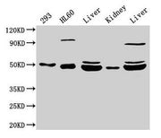 Western Blot Positive WB detected in: 293 whole cell lysate, HL60 whole cell lysate, Rat liver tissue, Mouse kidney tissue, Mouse liver tissue All lanes: NADK2 antibody at 4µg/ml Secondary Goat polyclonal to rabbit IgG at 1/50000 dilution Predicte...