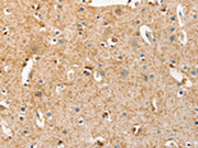 The image on the left is immunohistochemistry of paraffin-embedded Human brain tissue using CSB-PA678542(BRCA1 Antibody) at dilution 1/25, on the right is treated with fusion protein. (Original magnification: ×200)
