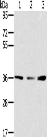 Gel: 8%SDS-PAGE, Lysate: 40 ug, Lane 1-3: Hepg2 cells, hela cells, 293T cells, Primary antibody: CSB-PA678622(SMN1 Antibody) at dilution 1/200, Secondary antibody: Goat anti rabbit IgG at 1/8000 dilution, Exposure time: 5 minutes