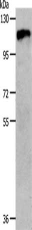 Gel: 8%SDS-PAGE, Lysate: 40 ug, Lane: 231 cells, Primary antibody: CSB-PA678661(CSF1R Antibody) at dilution 1/800, Secondary antibody: Goat anti rabbit IgG at 1/8000 dilution, Exposure time: 2 seconds