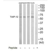 Western blot analysis of extracts from HuvEC, K562, HepG2 and A549 cells, using TAIP-12 antibody.