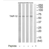 Western blot analysis of extracts from HuvEC, K562, HepG2 and A549 cells, using TAIP-12 antibody.