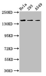 Western Blot Positive WB detected in: Hela whole cell lysate, 293 whole cell lysate, A549 whole cell lysate All lanes: CDON antibody at 3.4ug/ml Secondary Goat polyclonal to rabbit IgG at 1/50000 dilution Predicted band size: 140, 137 kDa Observed...