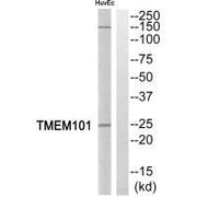 Western blot analysis of extracts from HuvEc cells, using TMEM101 antibody.