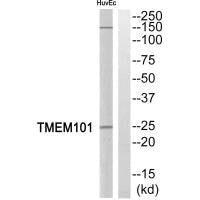 Western blot analysis of extracts from HuvEc cells, using TMEM101 antibody.