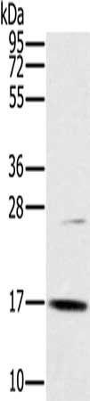 Gel: 10%SDS-PAGE, Lysate: 40 ug, Lane: A172 cells, Primary antibody: CSB-PA680694(OCIAD2 Antibody) at dilution 1/250, Secondary antibody: Goat anti rabbit IgG at 1/8000 dilution, Exposure time: 10 minutes