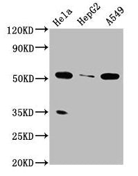 Western Blot Positive WB detected in: Hela whole cell lysate, HepG2 whole cell lysate, A549 whole cell lysate All lanes: MSS51 antibody at 4µg/ml Secondary Goat polyclonal to rabbit IgG at 1/50000 dilution Predicted band size: 52, 27, 11 kDa Obser...