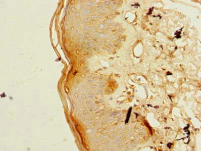 Immunohistochemistry of paraffin-embedded human skin tissue using CSB-PA681377LA01HU at dilution of 1:100