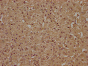 IHC image of CSB-PA681474NA01HU diluted at 1:100 and staining in paraffin-embedded human adrenal gland tissue performed on a Leica BondTM system. After dewaxing and hydration, antigen retrieval was mediated by high pressure in a citrate buffer (pH...