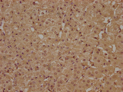 IHC image of CSB-PA681474NA01HU diluted at 1:100 and staining in paraffin-embedded human adrenal gland tissue performed on a Leica BondTM system. After dewaxing and hydration, antigen retrieval was mediated by high pressure in a citrate buffer (pH...