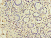 Immunohistochemistry of paraffin-embedded human small intestine tissue using CSB-PA681508LA01HU at dilution of 1:100