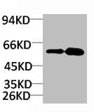 Western blot analysis of 1) Rat Brain Tissue, 2)Mouse Brain Tissue with KV11.1 Rabbit pAb diluted at 1:2,000.