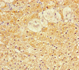 Immunohistochemistry of paraffin-embedded human adrenal gland tissue using CSB-PA683360LA01HU at dilution of 1:100