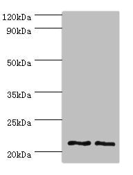 Western blot All lanes: DNAL1 antibody at 4ug/ml Lane 1: Hela whole cell lysate Lane 2: HepG2 whole cell lysate Secondary Goat polyclonal to rabbit IgG at 1/10000 dilution Predicted band size: 22, 9, 18 kDa Observed band size: 22 kDa