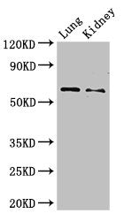 Western Blot Positive WB detected in: Mouse lung tissue, Mouse kidney tissue All lanes: Plbd2 antibody at 3ug/ml Secondary Goat polyclonal to rabbit IgG at 1/50000 dilution Predicted band size: 66 kDa Observed band size: 66 kDa