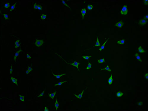 Immunofluorescence staining of SH-SY5Y cells with CSB-PA684467HA01HU-IF at 1:100, counter-stained with DAPI. The cells were fixed in 4% formaldehyde and blocked in 10% normal Goat Serum. The cells were then incubated with the antibody overnight at...
