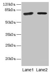 Western blot All lanes: KLHL22 antibody at 8µg/ml Lane 1: Jurkat whole cell lysate Lane 2: NIH/3T3 whole cell lysate Secondary Goat polyclonal to rabbit IgG at 1/10000 dilution Predicted band size: 72, 56 kDa Observed band size: 72 kDa