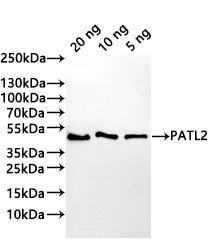 Western Blot Positive WB detected in: recombinant protein All lanes:PATL2 Antibody at 1:1000 Secondary Goat polyclonal to rabbit IgG at 1/20000 dilution Predicted band size: 38.4 kDa Observed band size: 40 kDa