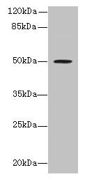 Western blot All lanes: RUNDC3A antibody at 1.5µg/ml + MCF-7 whole cell lysate Secondary Goat polyclonal to rabbit IgG at 1/10000 dilution Predicted band size: 50, 46, 42 kDa Observed band size: 50 kDa