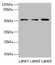 Western blot All lanes: ACSBG2 antibody at 4µg/ml Lane 1: A431 whole cell lysate Lane 2: K562 whole cell lysate Lane 3: A549 whole cell lysate Secondary Goat polyclonal to rabbit IgG at 1/10000 dilution Predicted band size: 75, 69, 54, 52 kDa Obse...