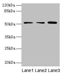 Western blot All lanes: ACSBG2 antibody at 4µg/ml Lane 1: A431 whole cell lysate Lane 2: K562 whole cell lysate Lane 3: A549 whole cell lysate Secondary Goat polyclonal to rabbit IgG at 1/10000 dilution Predicted band size: 75, 69, 54, 52 kDa Obse...