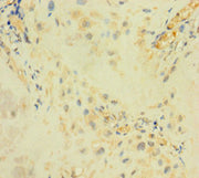 Immunohistochemistry of paraffin-embedded human placenta tissue using CSB-PA685925LA01HU at dilution of 1:100