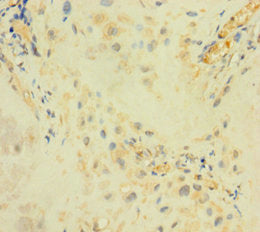 Immunohistochemistry of paraffin-embedded human placenta tissue using CSB-PA685925LA01HU at dilution of 1:100