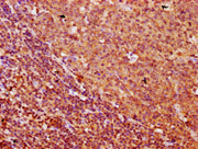 IHC image of CSB-PA686013LA01HU diluted at 1:500 and staining in paraffin-embedded human tonsil tissue performed on a Leica BondTM system. After dewaxing and hydration, antigen retrieval was mediated by high pressure in a citrate buffer (pH 6.0)....