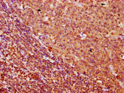 IHC image of CSB-PA686013LA01HU diluted at 1:500 and staining in paraffin-embedded human tonsil tissue performed on a Leica BondTM system. After dewaxing and hydration, antigen retrieval was mediated by high pressure in a citrate buffer (pH 6.0)....