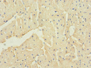 Immunohistochemistry of paraffin-embedded human heart tissue using CSB-PA686303LA01HU at dilution of 1:100