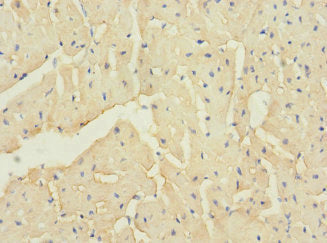 Immunohistochemistry of paraffin-embedded human heart tissue using CSB-PA686303LA01HU at dilution of 1:100