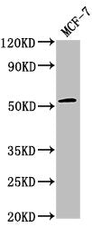 Western Blot Positive WB detected in: MCF-7 whole cell lysate All lanes: PPM1J antibody at 1:2000 Secondary Goat polyclonal to rabbit IgG at 1/50000 dilution Predicted band size: 55, 34 kDa Observed band size: 55 kDa