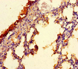 Immunohistochemistry of paraffin-embedded human lung tissue using CSB-PA686386LA01HU at dilution of 1:100
