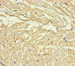 Immunohistochemistry of paraffin-embedded human heart tissue using CSB-PA687370LA01HU at dilution of 1:100