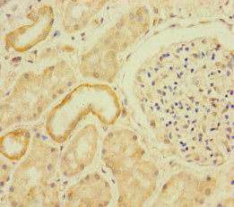 Immunohistochemistry of paraffin-embedded human kidney tissue using CSB-PA687456LA01HU at dilution of 1:100