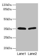 Western blot All lanes: HSD17B12 antibody at 1.2µg/ml Lane 1: U251 whole cell lysate Lane 2: A431 whole cell lysate Secondary Goat polyclonal to rabbit IgG at 1/10000 dilution Predicted band size: 35, 11 kDa Observed band size: 35 kDa