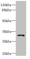 Western blot All lanes: UNC50 antibody at 0.2µg/ml + 293T whole cell lysate Secondary Goat polyclonal to rabbit IgG at 1/10000 dilution Predicted band size: 31 kDa Observed band size: 31 kDa