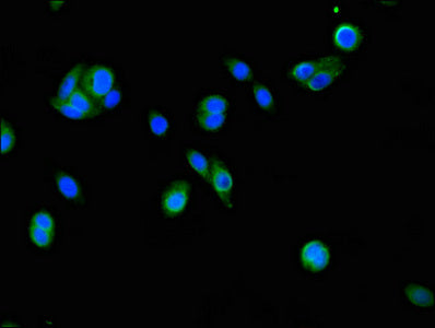 Immunofluorescent analysis of HepG2 cells using CSB-PA688567LA01HU at dilution of 1:100 and Alexa Fluor 488-congugated AffiniPure Goat Anti-Rabbit IgG(H+L)