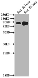 Western Blot Positive WB detected in: Rat Spleen tissue, Rat Kidney tissue All lanes: Ace2 antibody at 1:2000 Secondary Goat polyclonal to rabbit IgG at 1/50000 dilution Predicted band size: 93 kDa Observed band size: 93 kDa