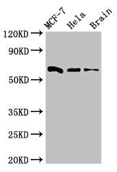 Western Blot Positive WB detected in: MCF-7 whole cell lysate, Hela whole cell lysate, Mouse brain tissue All lanes: SGO1 antibody at 3ug/ml Secondary Goat polyclonal to rabbit IgG at 1/50000 dilution Predicted band size: 65, 36, 34, 32, 30, 61, 2...