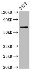 Western Blot Positive WB detected in: 293T whole cell lysate All lanes: ARSH antibody at 5.2µg/ml Secondary Goat polyclonal to rabbit IgG at 1/50000 dilution Predicted band size: 64 kDa Observed band size: 64 kDa