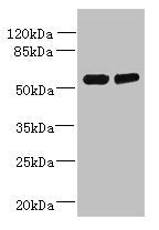 Western blot All lanes: TCTE1 antibody at 3µg/ml Lane 1: U251 whole cell lysate Lane 2: Mouse brain tissue Secondary Goat polyclonal to rabbit IgG at 1/10000 dilution Predicted band size: 56 kDa Observed band size: 56 kDa