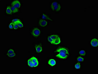 Immunofluorescent analysis of MCF-7 cells using CSB-PA690476LA01HU at dilution of 1:100 and Alexa Fluor 488-congugated AffiniPure Goat Anti-Rabbit IgG(H+L)