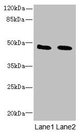 Western blot All lanes: IGSF11 antibody at 1.5µg/ml Lane 1: Mouse brain tissue Lane 2: Jurkat whole cell lysate Secondary Goat polyclonal to rabbit IgG at 1/10000 dilution Predicted band size: 47, 44 kDa Observed band size: 47 kDa