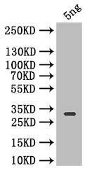 Western Blot Positive WB detected in: recombinant protein All lanes: Icarapin Antibody at 1:1000 Secondary Goat polyclonal to rabbit IgG at 1/50000 dilution Predicted band size: 27.8 kDa Observed band size: 27.8 kDa