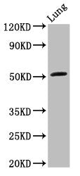 Western Blot Positive WB detected in: Rat lung tissue All lanes: ARHGAP1 antibody at 3.2ug/ml Secondary Goat polyclonal to rabbit IgG at 1/50000 dilution Predicted band size: 51 kDa Observed band size: 51 kDa