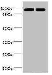 Western blot All lanes: PITRM1 antibody at 2µg/ml Lane 1: A549 whole cell lysate Lane 2: Mouse kidney tissue Secondary Goat polyclonal to rabbit IgG at 1/10000 dilution Predicted band size: 118, 107 kDa Observed band size: 118 kDa