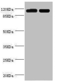 Western blot All lanes: PITRM1 antibody at 2µg/ml Lane 1: A549 whole cell lysate Lane 2: Mouse kidney tissue Secondary Goat polyclonal to rabbit IgG at 1/10000 dilution Predicted band size: 118, 107 kDa Observed band size: 118 kDa