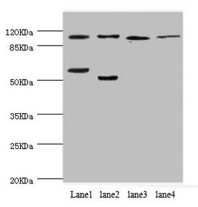 Western blot All lanes: PITRM1 antibody at 2.42ug/ml Lane 1: Mouse placenta tissue Lane 2: A549 whole cell lysate Lane 3: Rat gonad tissue Lane 4: Mouse kidney tissue Secondary Goat polyclonal to rabbit IgG at 1/10000 dilution Predicted band size:...