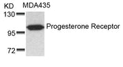 Western blot analysis of extracts from MDA435 cells using Progesterone Receptor(Ab-190) Antibody.